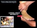Chronic Lateral Ankle Instability - Everything You Need To Know - Dr. Nabil Ebraheim
