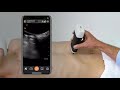 Abdominal Aortic Aneurysm (AAA): Ultrasound Scanning Technique