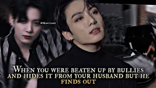 when you were beaten up by bullies and hides it from your husband but he finds out-Jungkook oneshot