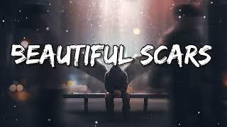 Scars to your beautiful - Alessia Cara (Lyrics)