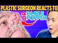 Plastic Surgeon Reacts to DR. PIMPLE POPPER! Massive Growth on NOSE! - Dr. Anthony Youn