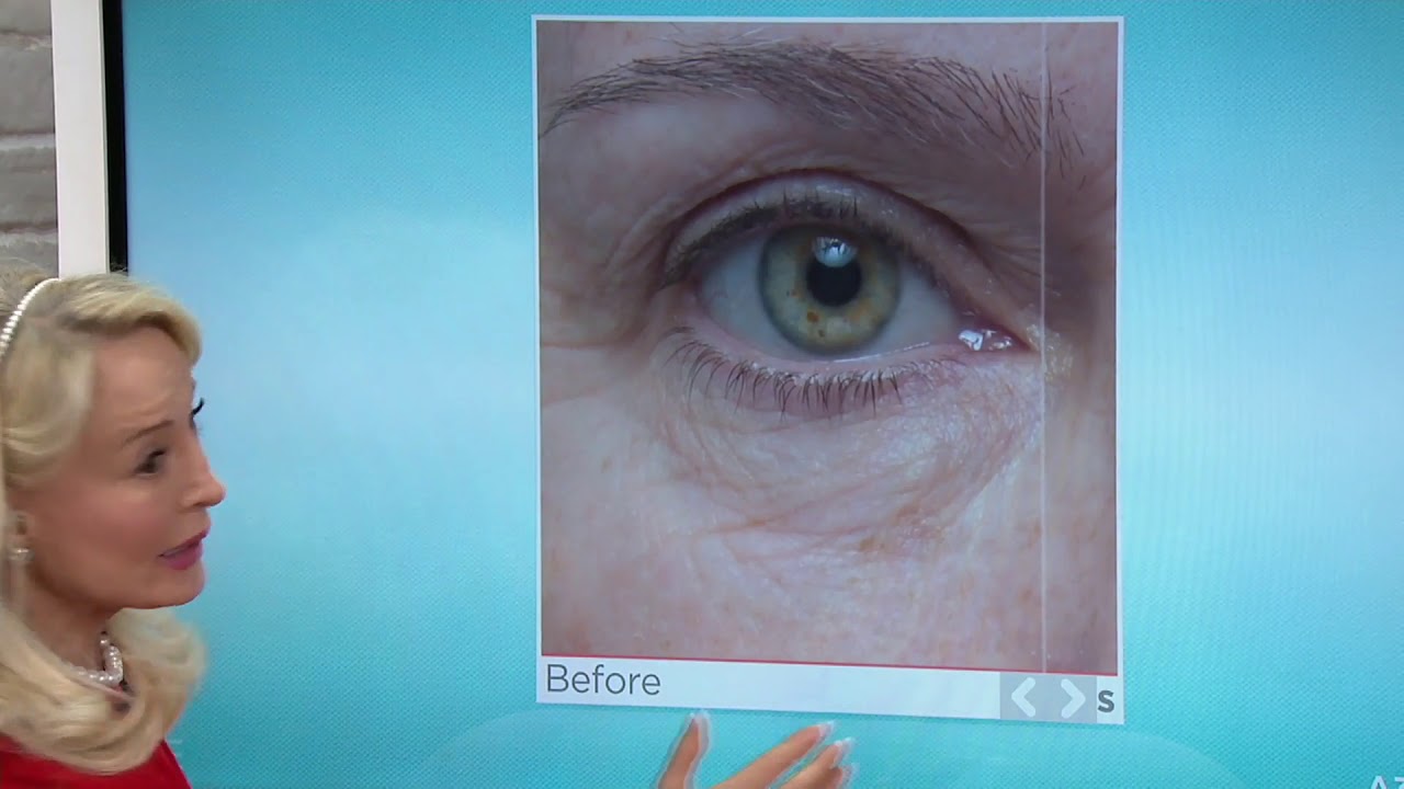 dr denese collagen eye cream