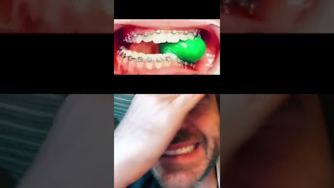 Qui a déjà mangé un chewing-gum avec les bagues 😭? Dites moi la vérité !!!!! 