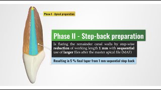 preclinical laboratory demonstration - cleaning and shaping - stepping back