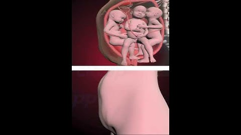 PRECIOUS MOMENTS OF TRIPLETS INSIDE THE WOMB  (3D ANIMATION)