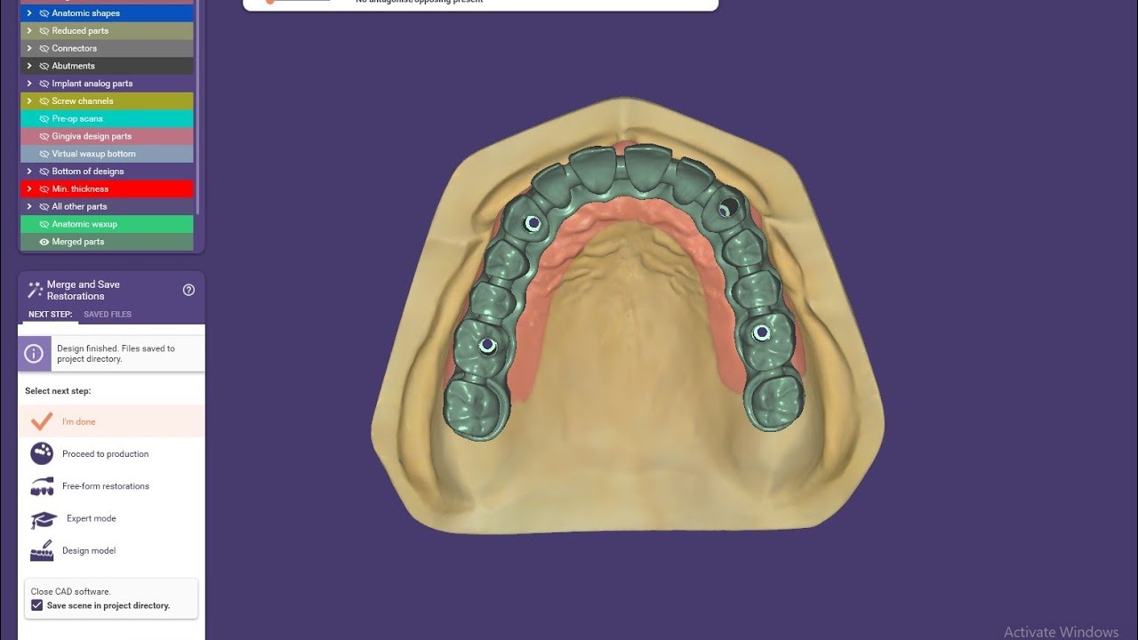 How to design screw retained implant/All on Four - Implant Bridge design with Exocad 3.0