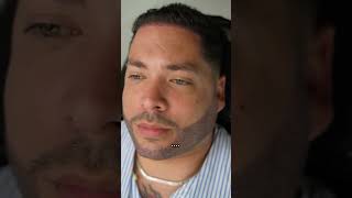 This is cosmetic tattooing ! A permanent hair enhancement