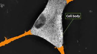 Celebrity Morphological evolution of cortical neuron cells over time under Nanolive live cell imaging solution Profile