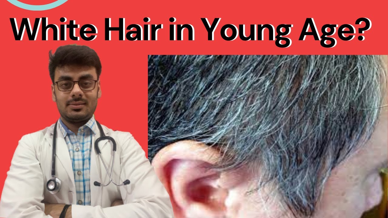 White Hair In Young People ? || Doctor Ishraque Raza - YouTube