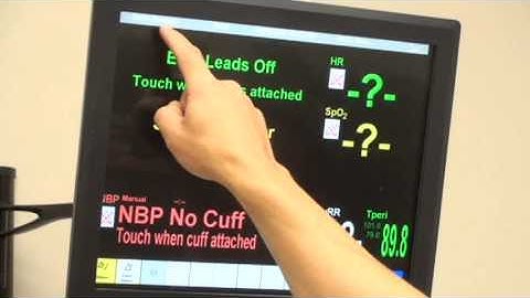 Using the Patient Monitor