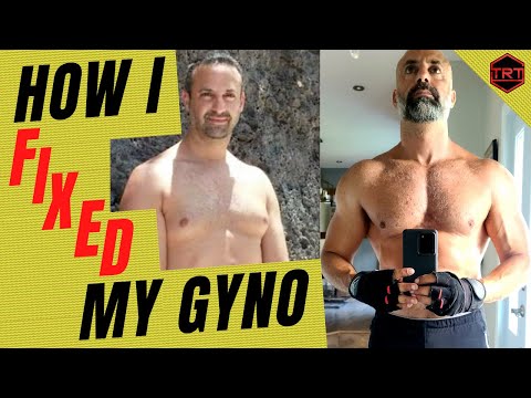 How I Fixed My Gynecomastia: How To Get Rid Of It With TRT (by Danny Bossa TRT)