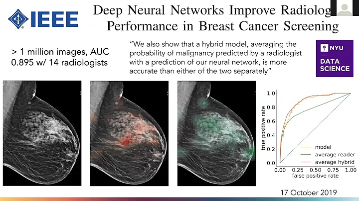 Johns Hopkins Blalock-Taussig-...  Heart Centers W...