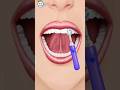 Teeth Cleaning by a Dentist Game #shorts