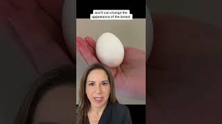 What Is A Breast Implant Capsule? By Hayley Brown, Md Desert Hills Plastic Surgery