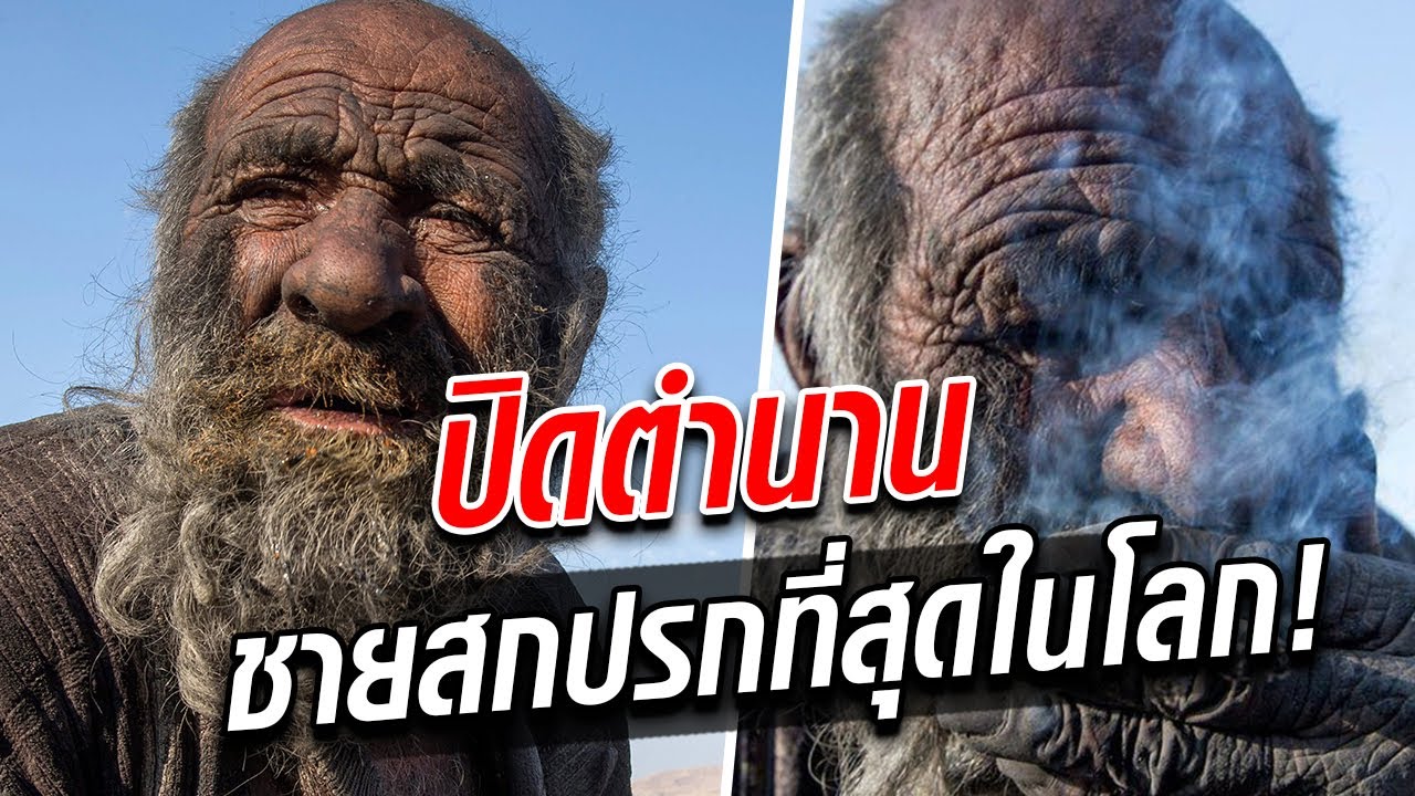 ปิดตำนาน ชายที่สกปรกที่สุดในโลก ไม่อาบน้ำ 67 ปี พอยอมอาบไม่นาน…สิ้นใจ : Khaosod TV