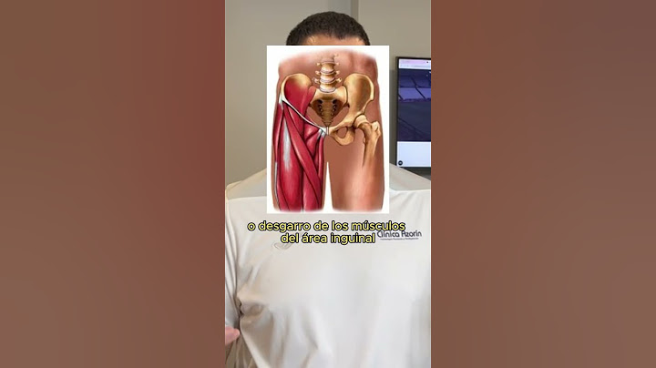 Esta lesión en muy común en deportistas: ¿Qué es la distensión inguinal?