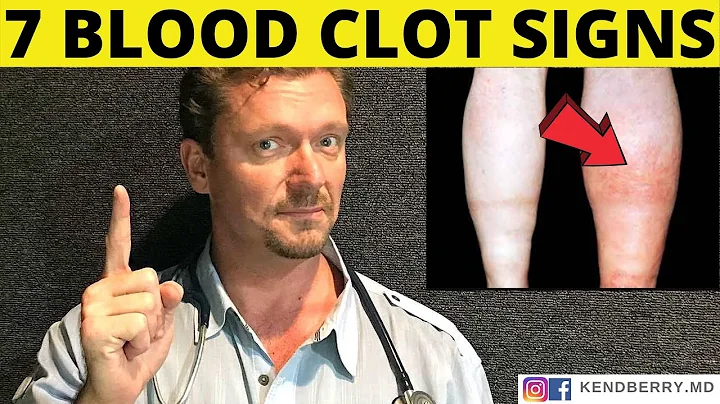 7 Warning Signs of a BLOOD CLOT (Symptoms) 2024 - DayDayNews