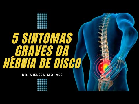 5 SINTOMAS GRAVES
