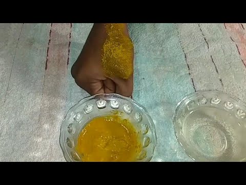 ringworm-remove-natura-way-|-how-to-remove-ringworm-natural-way.-#healthlovely