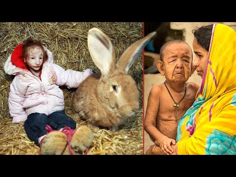 WORLD'S MOST UNUSUAL KIDS YOU'VE EVER SEEN