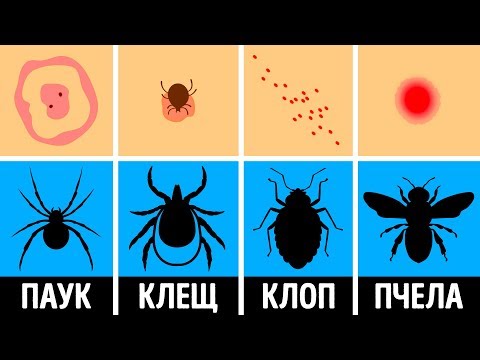 Видео: Как распознать укусы насекомых: 15 шагов (с изображениями)