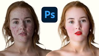 How to do Face Retouching on Photoshop | How to Retouch Skin | Best Photoshop Tutorial 2023