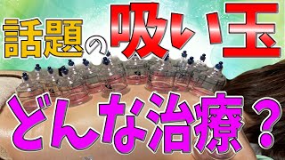 【吸い玉 カッピング 宮崎】吸い玉って、どんな治療？話題の吸い玉をご紹介！！