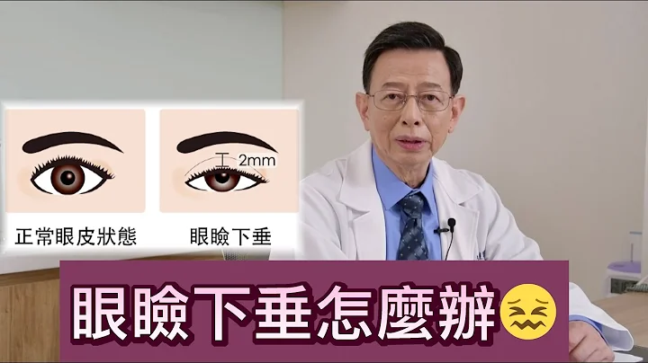 眼瞼下垂怎麼辦？【晶華美醫診所】徐典雄醫師｜台北眼瞼下垂手術 眼瞼下垂手術推薦 眼瞼下垂治療改善 - 天天要聞