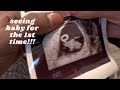 Baby s first appointment  mini vlog