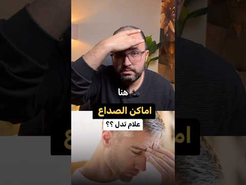انواع الصداع واسبابه صداع الم الراس دكتورك الامين