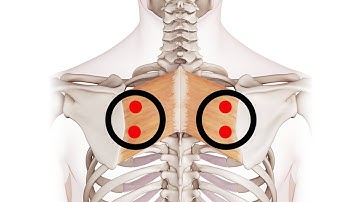Exploring the Rhomboids: Understanding Trigger Point Locations for Better Muscle Health