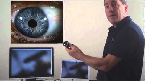 Dino-Lite Product - Iris Scope