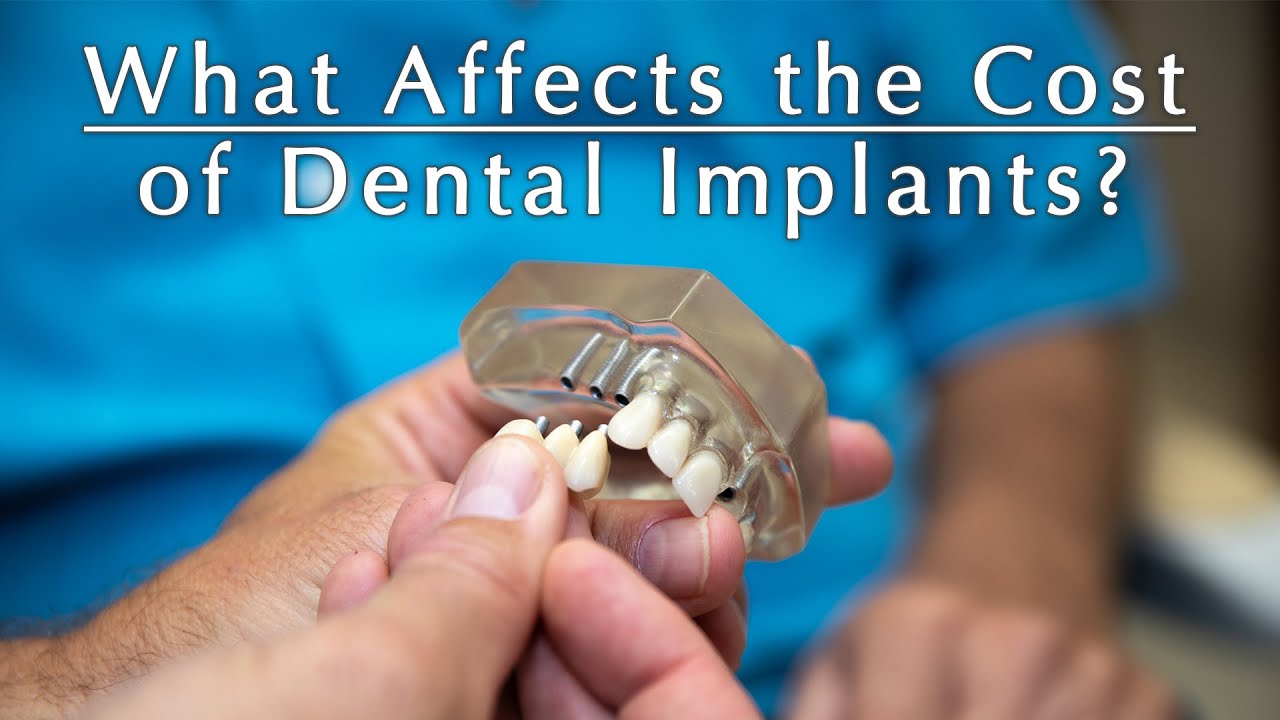 Comparing the Bottom Line. Things to Consider when Pricing Dental Implants.