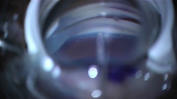 iStent Implantation Video