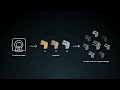 SyMRI KNEE: Advanced Quantitative Imaging With A Faster Workflow