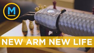 11-year-old boy with bionic arm says he feels like Iron Man | Your Morning