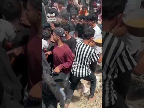 طفل فلسطيني يتعرض لحروق بعد انسكاب الطعام الساخن على جسده في قطاع غزة