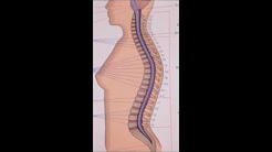 Disability from Spinal Stenosis and Arthritis