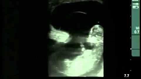 Cow #4539 Day 57 of Gestation