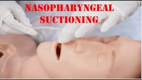 Nasopharyngeal suctioning New NMC Skill 2022
