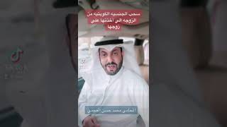 سحب الجنسيه الكويتيه من المتجنسه علي زوجها بالتبعيه