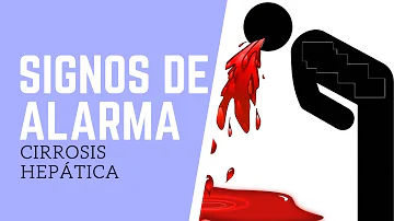 ¿Hay señales de alarma antes de la cirrosis?