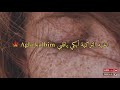 اغنية تركية أبكي ياقلبي Ağla Kalbim 