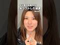 【糸リフト】北〇景子似美女が糸リフトした結果#shorts