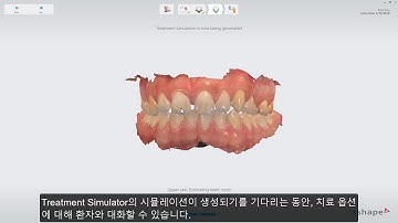 3Shape 트리오스 – 트리오스 Treatment Simulator 워크플로  - TRIOS Treatment Simulator Workflow