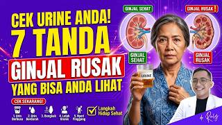 CHECK YOUR URINE! 7 VISIBLE SIGNS OF KIDNEY DAMAGE