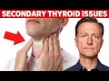 Most Thyroid Issues Are Secondary to Other Problems