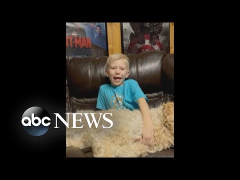 Hero 6-year-old boy bitten by dog shares update | WNT