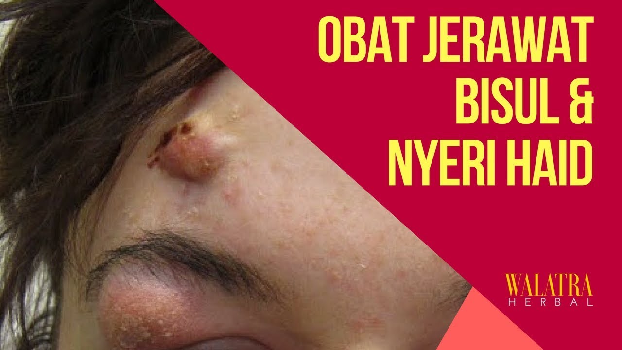 Cara Mengobati Bisul & Nyeri Haid - Testimoni BERSIH WANITA