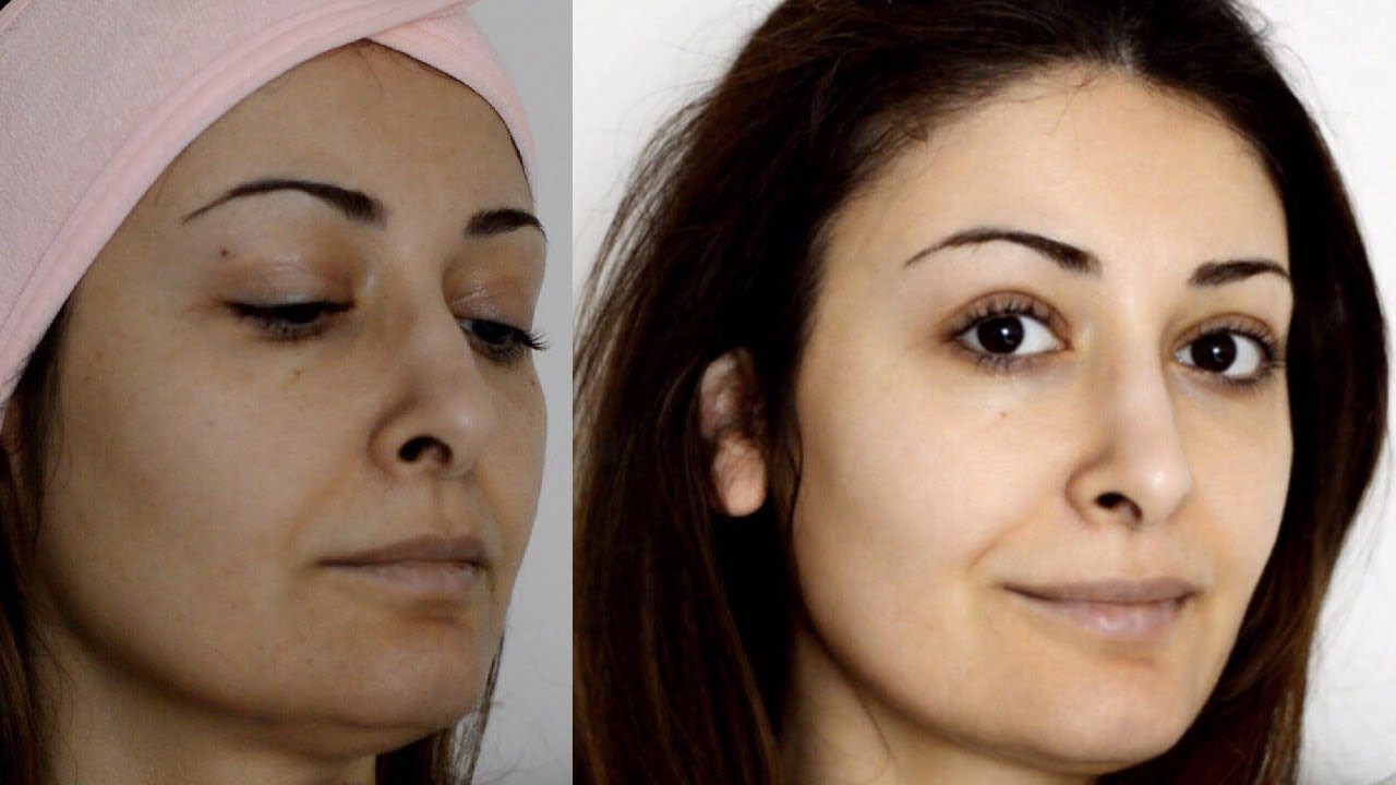 آشپزی بوراک میدونستید آسپیرین رو پوست صورت معجزه میکنه؟ پیلینگ خانگی و طبیعی، روشن کننده پوست ۵ سال جوانتر شوید
